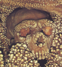 Uomo di Altamura